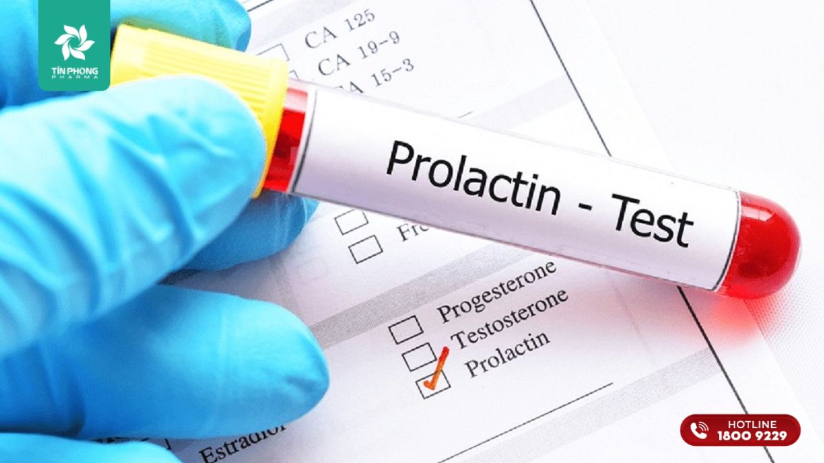 Xét nghiệm prolactin máu